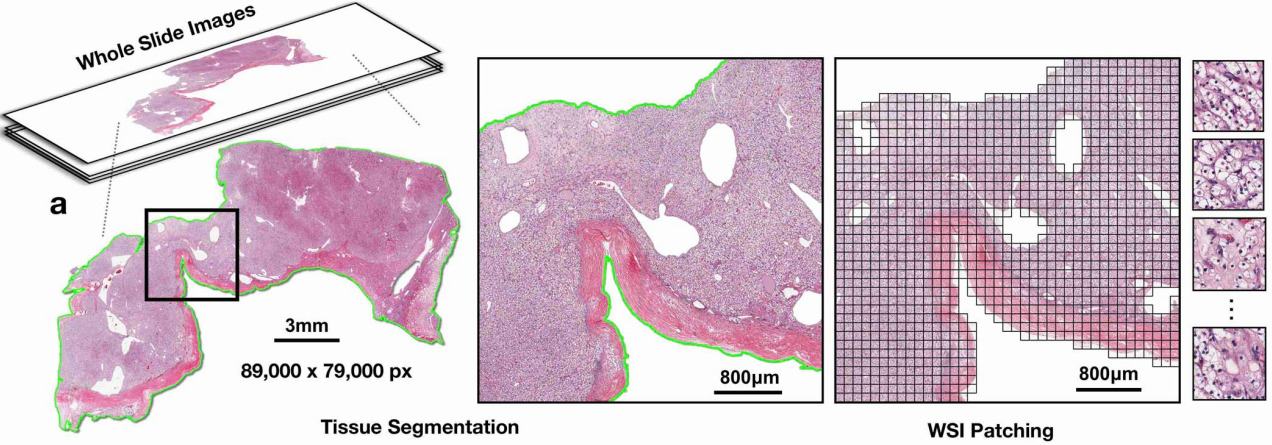 Whole Slide Image (WSI) processing.